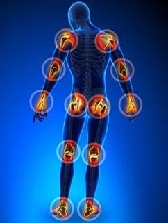 Location of the joints affected by osteoarthritis