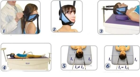 treatment of cervical osteochondrosis by traction