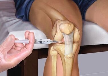 Injection in the joint